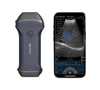 xl pro ultrasound device 1