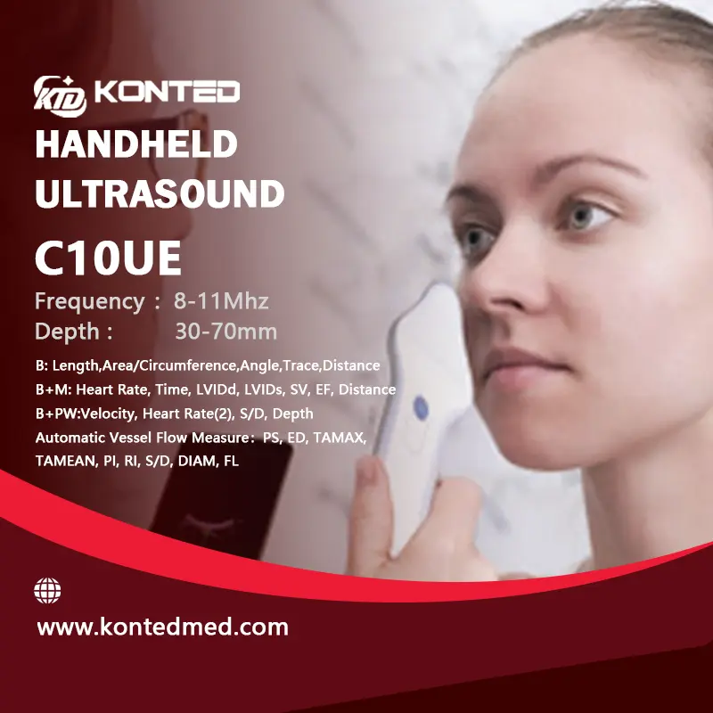 Konted C10UEの眼科超音波の特徴