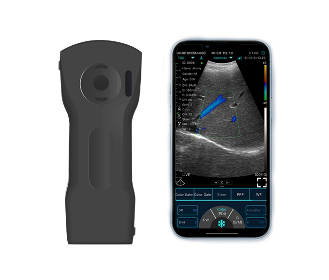 c10xs handheld ultrasound2