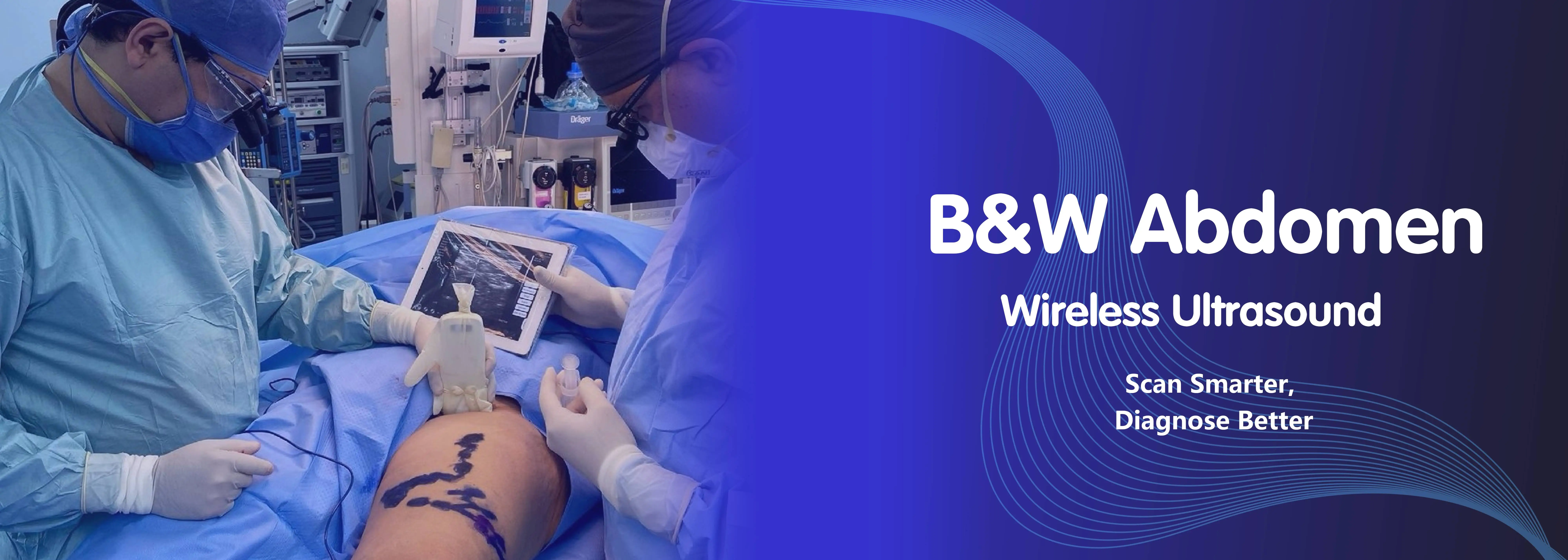 B & W腹部超音波